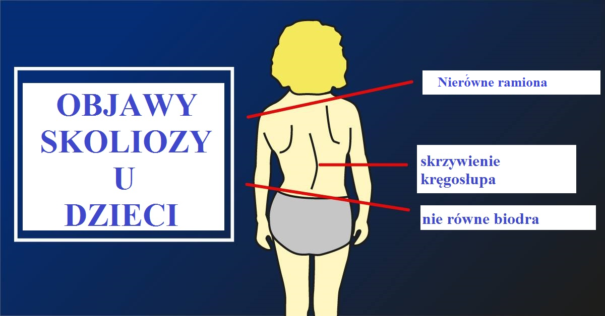 Gorset ortopedyczny dla dziecka 